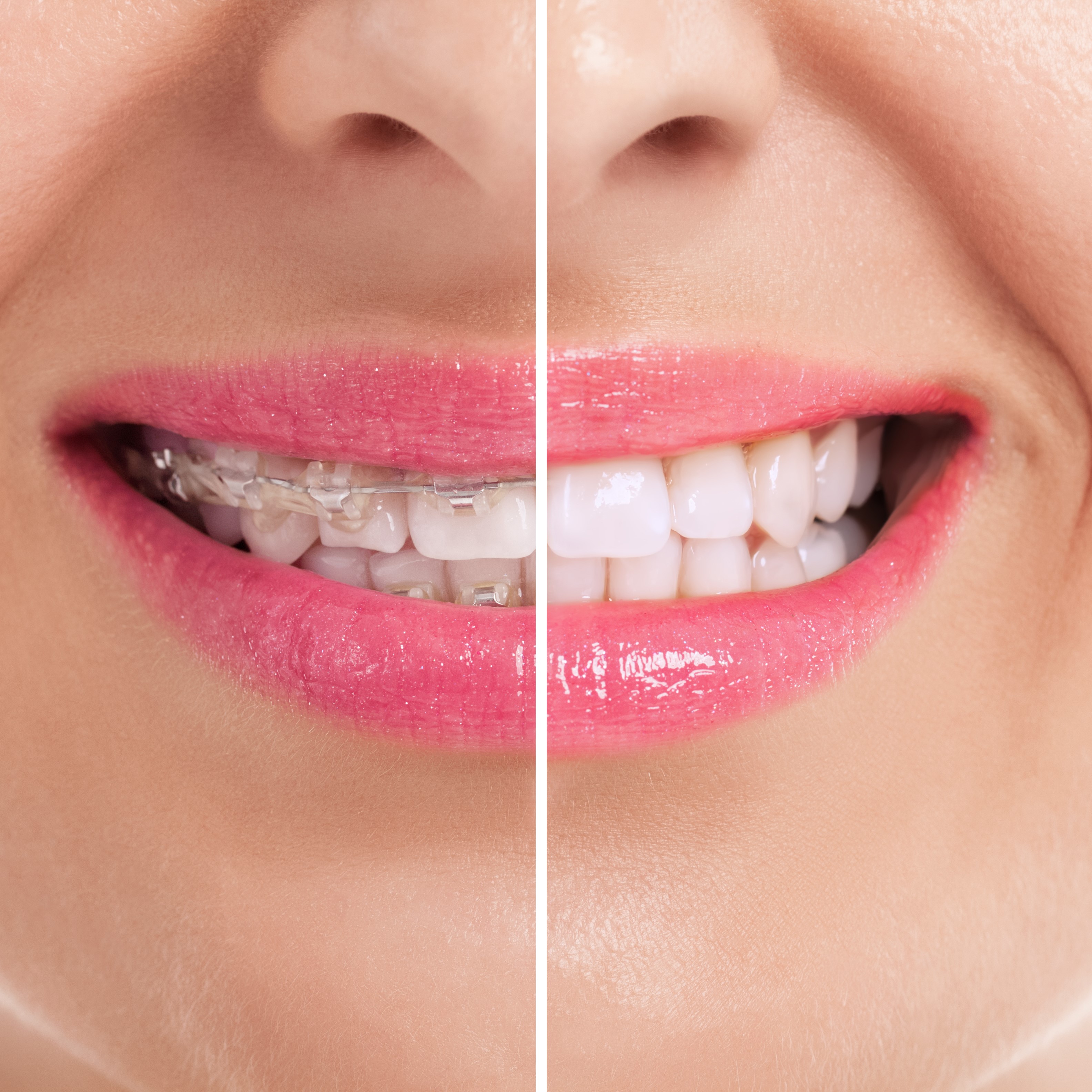 Oaks Dental Korea Procedure